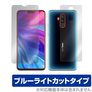 Ulefone T2 \ w tB OverLay Eye Protector for EtH X}[gtH T2 \ʁEwʃZbg ڂɂ₳ u[Cg Jbg ~rbNX