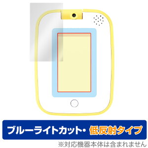 ݂Rpbh ی tB OverLay Eye Protector ᔽ for ݂R炵 ƗVŊwׂႤI݂Rpbh tی u[CgJbg ~rbNX