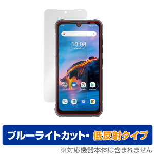 UMIDIGI BISON Pro �ی� �t�B���� OverLay Eye Protector �ᔽ�� for ���~�f�B�W �o�C�\�� �v�� �t���ی� �u���[���C�g�J�b�g �f�荞�݂�}���� �~���r�b�N�X