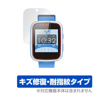 AGPTEK LbYX}[gEHb` W11X ی tB OverLay Magic for AGPTEK X}[gEHb` W11X tی LYC ώw hw R[eBO ~rbNX