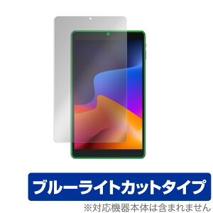 VASTKING KingPad SA10 ی tB OverLay Eye Protector for VASTKING ^ubg KingPad SA10 tی ڂɂ₳ u[Cg Jbg ~rbNX