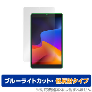 VASTKING KingPad SA10 ی tB OverLay Eye Protector ᔽ for VASTKING ^ubg KingPad SA10 tی u[CgJbg f荞݂} ~rbNX