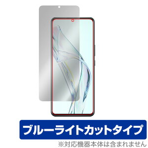ZTE Axon 30 ی tB OverLay Eye Protector for ZTE X}[gtH Axon30 [bgeB[C[ tی ڂɂ₳ u[Cg Jbg ~rbNX