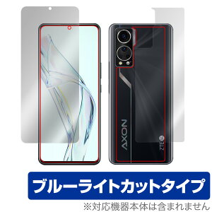 ZTE Axon 30 \ w tB OverLay Eye Protector for ZTE X}[gtH Axon30 [bgeB[C[ \ʁEwʃZbg ڂɂ₳ u[Cg Jbg ~rbNX