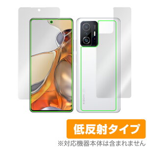 Xiaomi 11T Pro Xiaomi 11T �\�� �w�� �t�B���� OverLay Plus for �V���I�~�[ �X�}�[�g�t�H�� 11T Pro �\�ʁE�w�ʃZ�b�g �A���`�O���A �ᔽ�� ����� �h�w�� �~���r�b�N�X