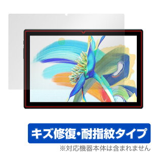 Teclast M40 Pro �ی� �t�B���� OverLay Magic for �e�N���X�g �^�u���b�g M40 �v�� �t���ی� �L�Y�C�� �ώw�� �h�w�� �R�[�e�B���O �~���r�b�N�X