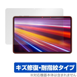 ALLDOCUBE iPlay 40H ی tB OverLay Magic for I[hL[u ^ubg iPlay40H tی LYC ώw hw R[eBO ~rbNX