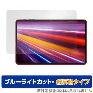 ALLDOCUBE iPlay 40H ی tB OverLay Eye Protector ᔽ for I[hL[u ^ubg iPlay40H tی u[CgJbg f荞݂} ~rbNX