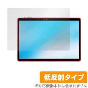 ALLDOCUBE iPlay 20S ی tB OverLay Plus for I[hL[u ^ubg iPlay20S tی A`OA ᔽ  hw ~rbNX