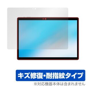 ALLDOCUBE iPlay 20S ی tB OverLay Magic for I[hL[u ^ubg iPlay20S tی LYC ώw hw R[eBO ~rbNX