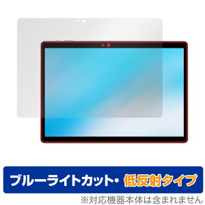 ALLDOCUBE iPlay 20S ی tB OverLay Eye Protector ᔽ for I[hL[u ^ubg iPlay20S tی u[CgJbg f荞݂} ~rbNX