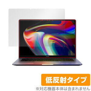 Xiaomi Mi Notebook Pro 14 (2021) ی tB OverLay Plus for VI~[ ~[ m[gubN v 14 tی A`OA ᔽ  hw ~rbNX