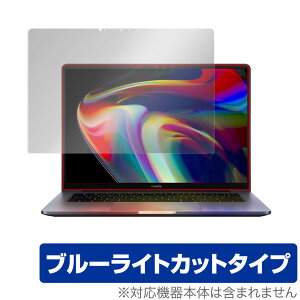 Xiaomi Mi Notebook Pro 14 (2021) ی tB OverLay Eye Protector for VI~[ ~[ m[gubN v 14 tی ڂɂ₳ u[CgJbg ~rbNX