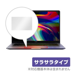Xiaomi Mi Notebook Pro 14 (2021) gbNpbh ی tB OverLay Protector for VI~[ ~[ m[gubN v 14 ی A`OA 炳 ~rbNX