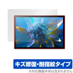 Blackview OSCAL Pad 8 �ی� �t�B���� OverLay Magic for �u���b�N�r���[ �I�X�J�� �p�b�h 8 �t���ی� �L�Y�C�� �ώw�� �h�w�� �R�[�e�B���O �~���r�b�N�X