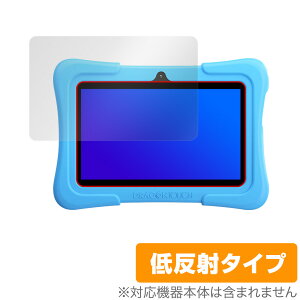 Dragon Touch Y88X Plus KidzPad �ی� �t�B���� OverLay Plus for �h���S���^�b�` DragonTouch �t���ی� �A���`�O���A �ᔽ�� ����� �h�w�� �~���r�b�N�X