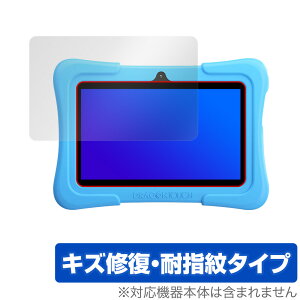Dragon Touch Y88X Plus KidzPad �ی� �t�B���� OverLay Magic for �h���S���^�b�` DragonTouch �t���ی� �L�Y�C�� �ώw�� �h�w�� �R�[�e�B���O �~���r�b�N�X
