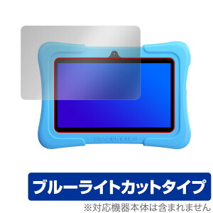 Dragon Touch Y88X Plus KidzPad �ی� �t�B���� OverLay Eye Protector for �h���S���^�b�` DragonTouch �t���ی� �ڂɂ₳���� �u���[���C�g �J�b�g �~���r�b�N�X