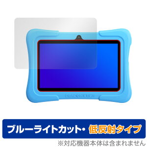 Dragon Touch Y88X Plus KidzPad �ی� �t�B���� OverLay Eye Protector �ᔽ�� for �h���S���^�b�` DragonTouch �t���ی� �u���[���C�g�J�b�g �f�荞�݂�}���� �~���r�b�N�X