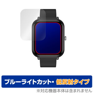 X}[gEHb` Q9 PRO 1.7C`f یtB OverLay Eye Protector ᔽ X}[gEHb`ptB u[CgJbg