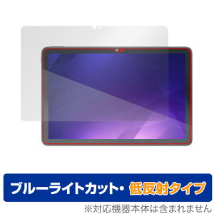 IRIS OHYAMA LUCA Tablet 10C` TM101N1-B ی tB OverLay Eye Protector ᔽ for ACXI[} ^ubg TM101N1B u[CgJbg
