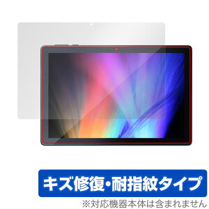 IRIS OHYAMA LUCA Tablet 10C` TE101N1-B ی tB OverLay Magic for ACXI[} ^ubg TE101N1B tی LYC ώw hw