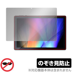 IRIS OHYAMA LUCA Tablet 10C` TE101N1-B ی tB OverLay Secret for ACXI[} ^ubg TE101N1B tی vCoV[tB^[