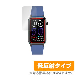 itDEAL �X�}�[�g�E�H�b�` E5 �ی� �t�B���� OverLay Plus for itDEAL �X�}�[�g�E�H�b�`E5 �t���ی� �A���`�O���A �ᔽ�� ����� �h�w��