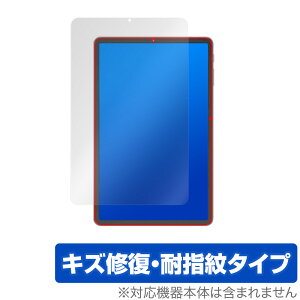 ALLDOCUBE kPad ی tB OverLay Magic for I[hL[u ^ubg kPad tی LYC ώw hw R[eBO