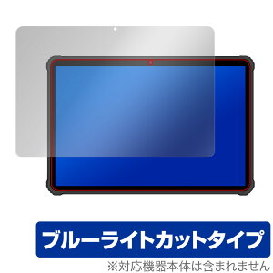 OUKITEL RT1 ی tB OverLay Eye Protector for IELe ^ubg RT1 tی ڂɂ₳ u[Cg Jbg