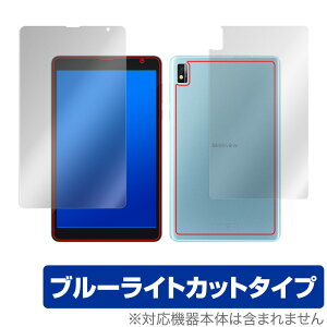 Blackview Tab 6 BlackviewTab6 Kids \ w tB OverLay Eye Protector for ubNr[ ^u 6 LbY \ʁEwʃZbg u[Cg Jbg