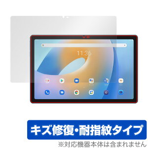 Blackview Tab 11 ی tB OverLay Magic for ubNr[ ^u 11 Tab11 tی LYC ώw hw R[eBO ^ubg