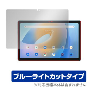 Blackview Tab 11 ی tB OverLay Eye Protector for ubNr[ ^u 11 Tab11 tی ڂɂ₳ u[CgJbg ^ubg