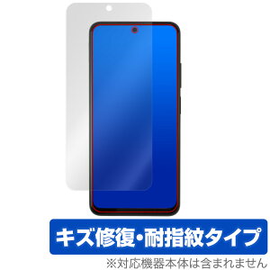 Xiaomi Redmi Note 11S / 11 保護 フィルム OverLay Magic シャオミー スマホ レドミ ノート 液晶保護 傷修復 耐指紋 指紋防止