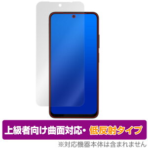 Xiaomi Redmi Note 11S / 11 ی tB OverLay FLEX ᔽ VI~[ X}z h~ m[g ȖʑΉ _f ˖h~ Ռz