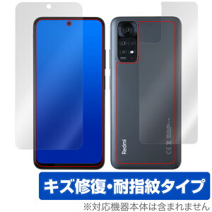 Xiaomi Redmi Note 11S / 11 \ w tB OverLay Magic VI~[ X}z h~ m[g \ʔwʃZbg C ώw wh~