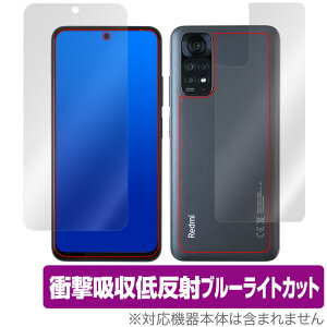 Xiaomi Redmi Note 11S / 11 \ w tB Zbg OverLay Absorber ᔽ VI~[ h~ m[g Ռz ˖h~ R