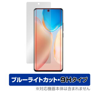 vivo X70 Pro �ی� �t�B���� OverLay Eye Protector 9H for vivo �X�}�[�g�t�H�� X70 �v�� �t���ی� 9H ���d�x �u���[���C�g�J�b�g