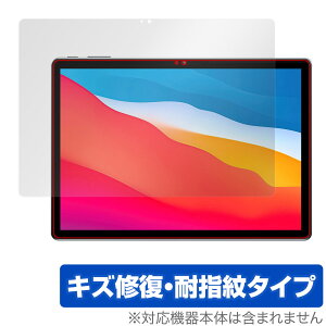 ALLDOCUBE X Game ی tB OverLay Magic for I[hL[u X Q[ ^ubg tی LYC ώw hw R[eBO