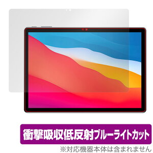 ALLDOCUBE X Game ی tB OverLay Absorber for I[hL[u X Q[ ^ubg Ռz ᔽ u[CgJbg Au\[o[ R