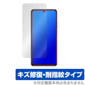 Xiaomi Redmi Note 11 Pro ی tB OverLay Magic for VI~[ h~ m[g11Pro tی LYC ώw hw R[eBO