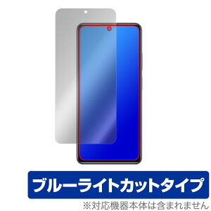 Xiaomi Redmi Note 11 Pro ی tB OverLay Eye Protector for VI~[ h~ m[g11Pro tی ڂɂ₳ u[CgJbg