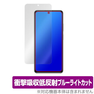 Xiaomi Redmi Note 11 Pro ی tB OverLay Absorber for VI~[ h~ m[g11Pro Ռz ᔽ u[CgJbg Au\[o[ R