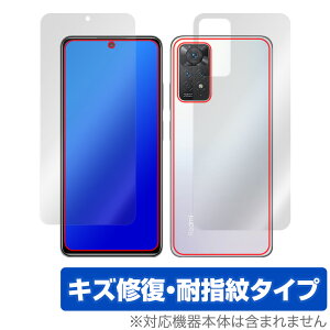 Xiaomi Redmi Note 11 Pro \ w tB OverLay Magic for VI~[ h~ m[g11Pro \ʁEwʃZbg LYC ώw hw R[eBO