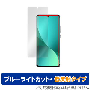Xiaomi 12 Pro �ی� �t�B���� OverLay Eye Protector �ᔽ�� for �V���I�~�[ �X�}�[�g�t�H�� 12 �v�� �t���ی� �u���[���C�g�J�b�g �f�荞�݂�}����
