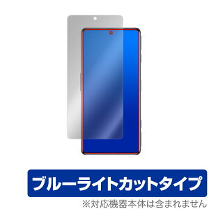 Xiaomi Redmi K50G ی tB OverLay Eye Protector for VI~[ h~ K50G tی ڂɂ₳ u[CgJbg