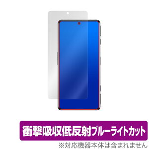 Xiaomi Redmi K50G ی tB OverLay Absorber for VI~[ h~ K50G Ռz ᔽ u[CgJbg Au\[o[ R