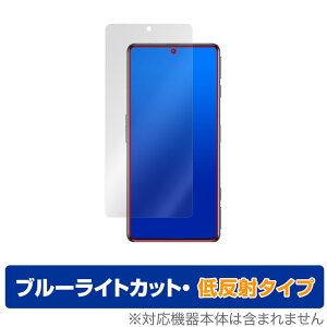 Xiaomi Redmi K50G ی tB OverLay Eye Protector ᔽ for VI~[ h~ K50G tی u[CgJbg f荞݂}