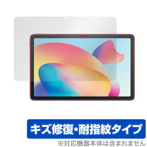 TCL TAB MAX 10.4 ی tB OverLay Magic for TCL TAB MAX 10.4 ^ubg tی LYC ώw hw R[eBO