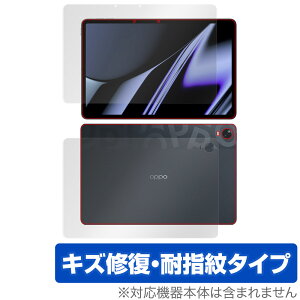 OPPO Pad OPD2101 �\�� �w�� �t�B���� OverLay Magic for �I�b�| Pad OPD2101 �^�u���b�g �\�ʁE�w�ʃZ�b�g �L�Y�C�� �ώw�� �h�w�� �R�[�e�B���O